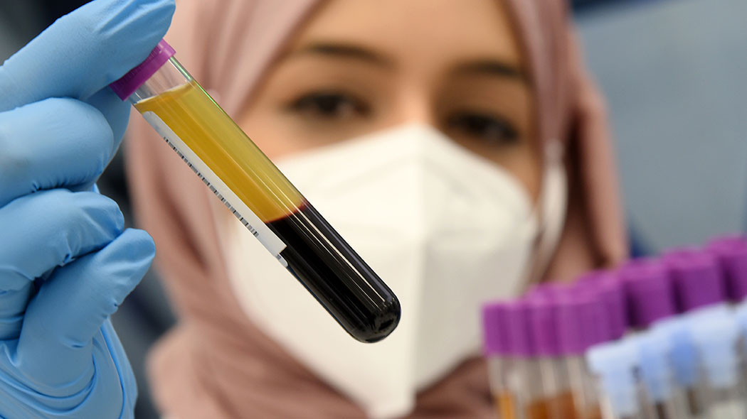 Своевременный анализ крови поможет выявить травму головного мозга